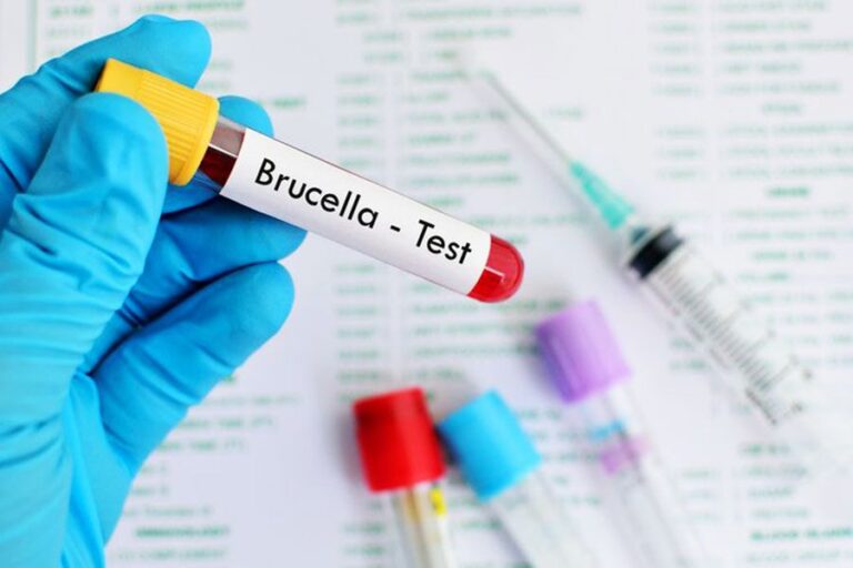 brucellosis